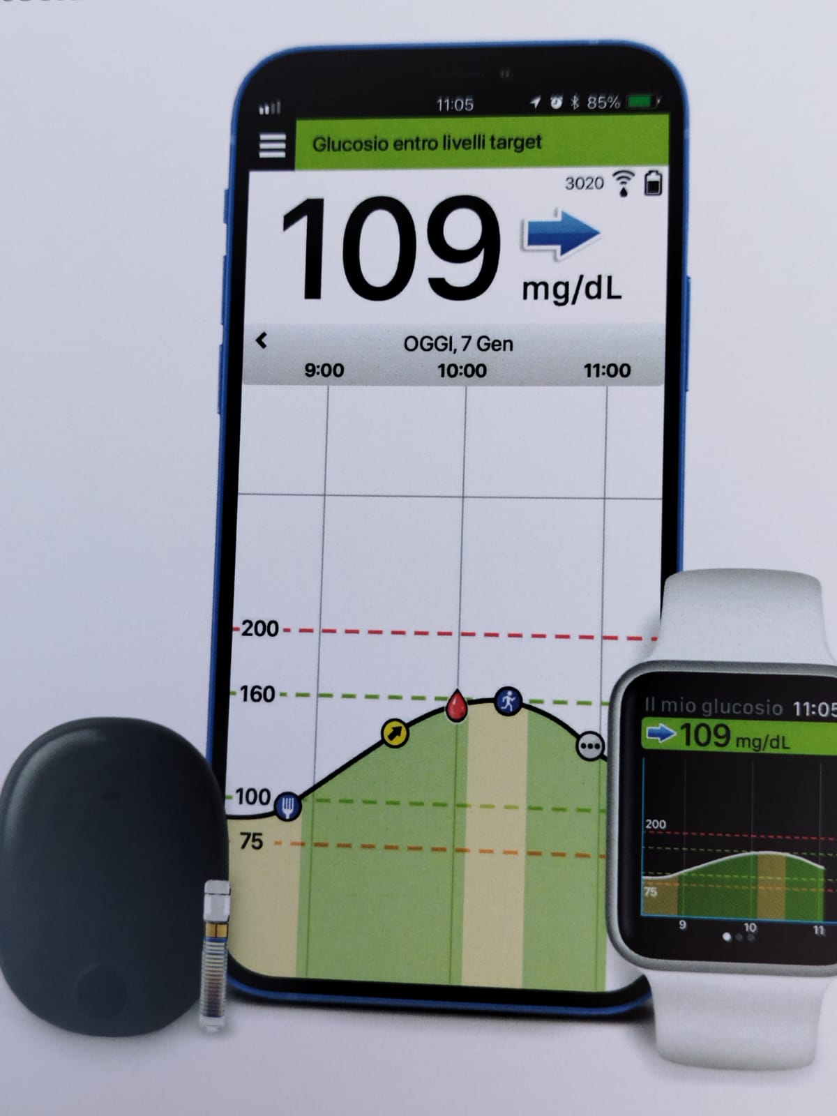 Diabete, primi sensori sottocutanei glicemia impiantati a Nuoro