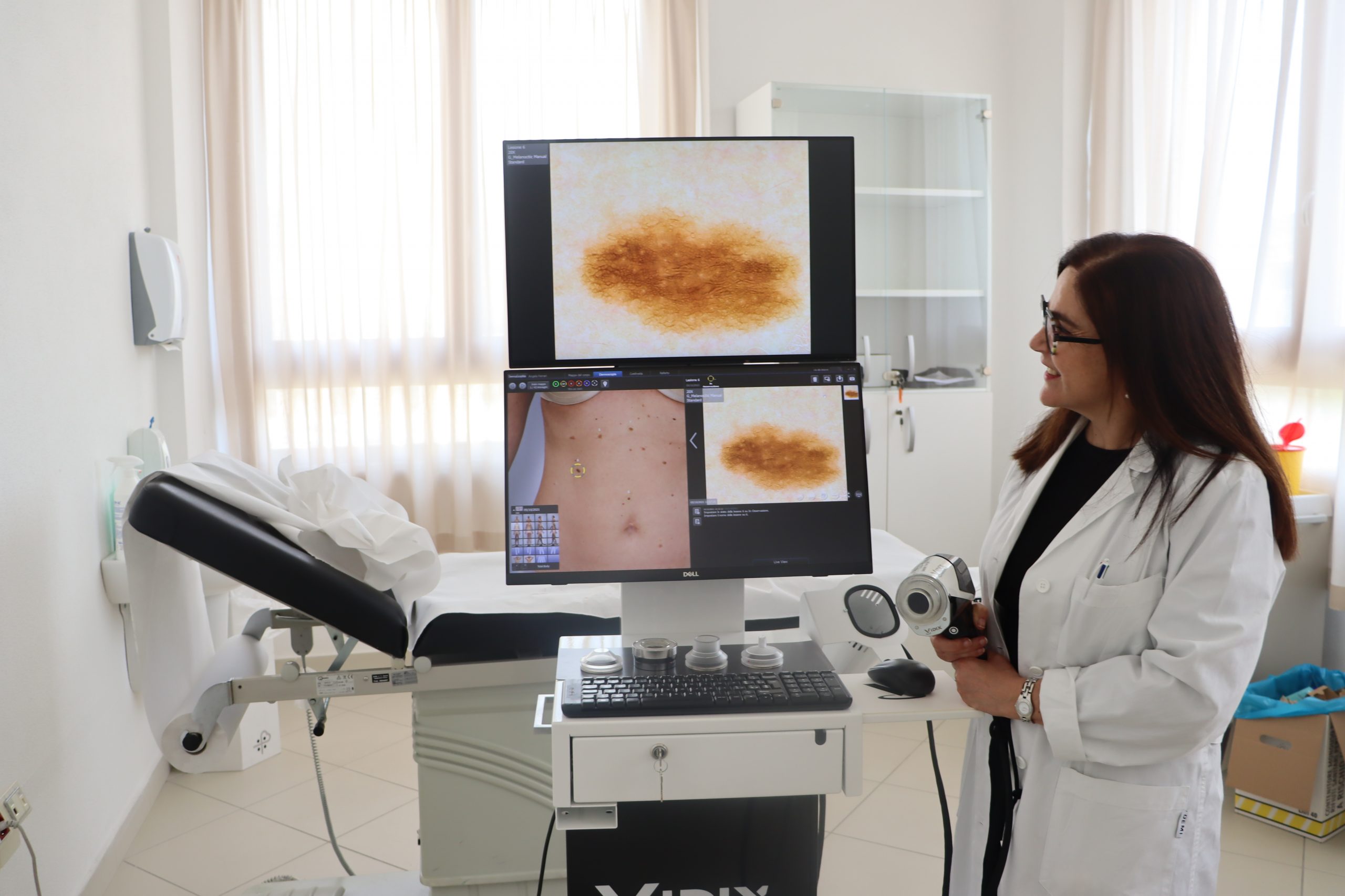 Casa della Comunità. Un nuovo videodermatoscopio digitale Casa della Comunità. Un nuovo videodermatoscopio digitale